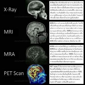 Brain Imagine